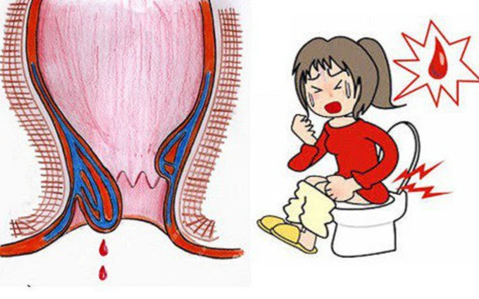 Trẻ em có máu khi đi vệ sinh cần làm gì?