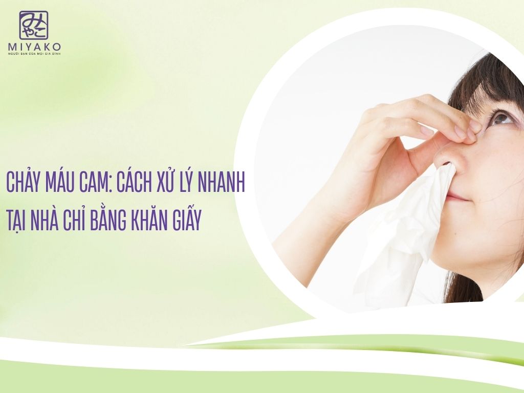 Chảy máu cam - Cách xử lý nhanh tại nhà chỉ bằng khăn giấy